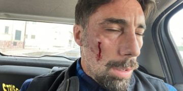 VITTORIO BRUMOTTI DOPO L'AGGRESSIONE